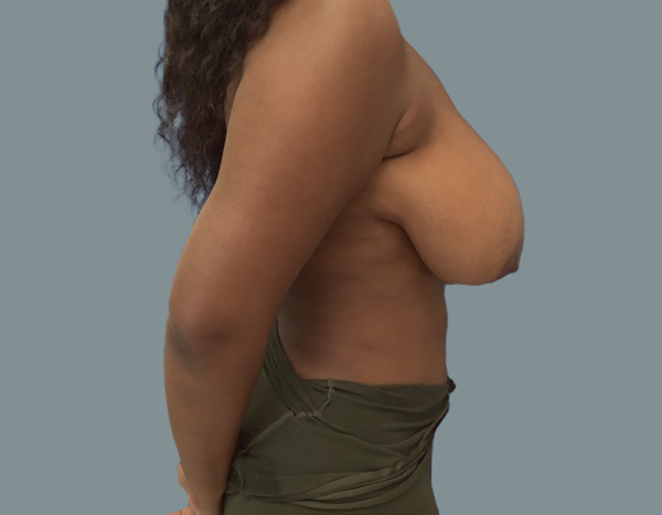 Before right side
