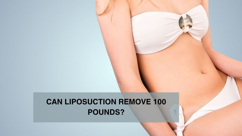 Can Liposuction Remove 100 Pounds