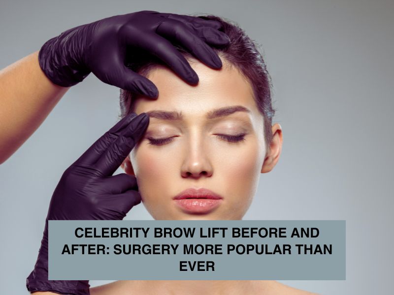 /Celebrity Brow Lift Before and After Surgery More Popular Than Ever