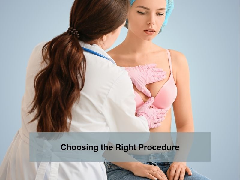 Choosing the Right Procedure