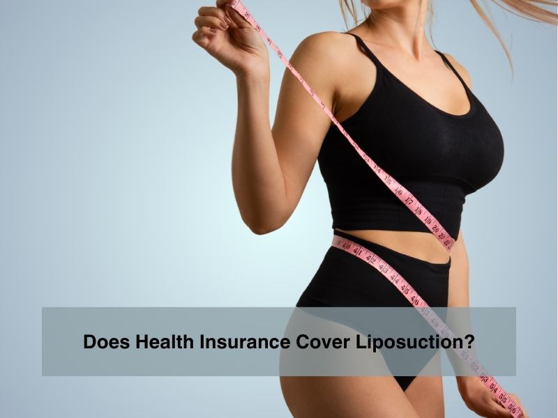 Does Health Insurance Cover Liposuction