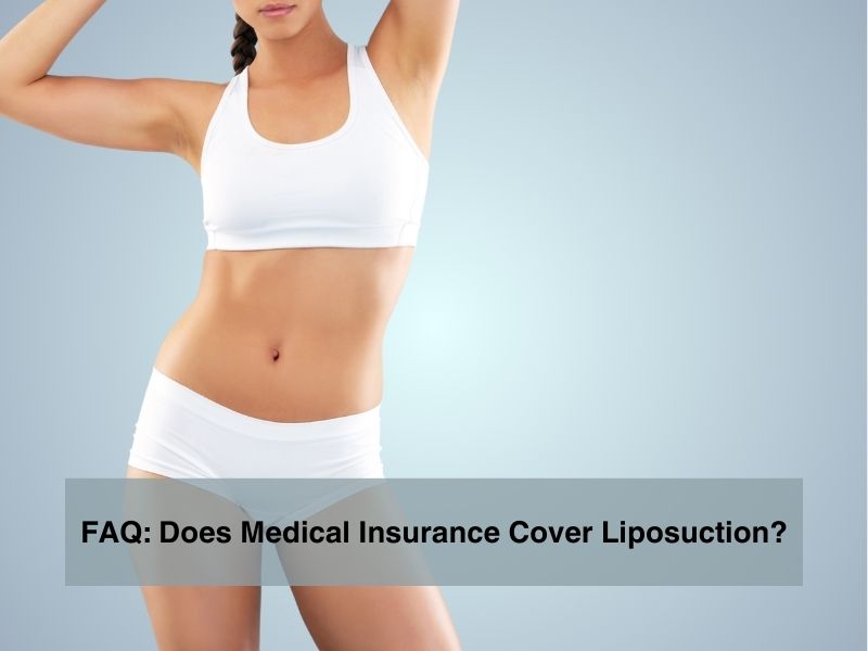FAQ: Does Medical Insurance Cover Liposuction