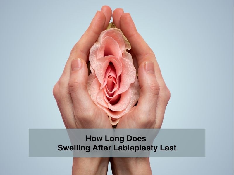 How Long Does Swelling After Labiaplasty Last