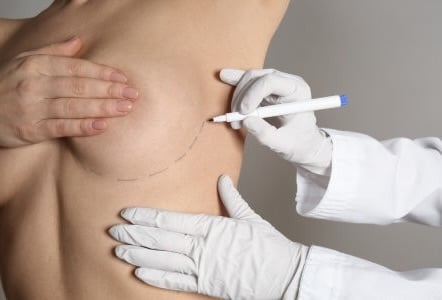 Implant Incision