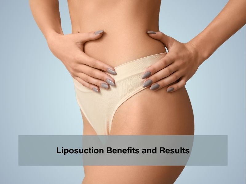 Liposuction Benefits and Results