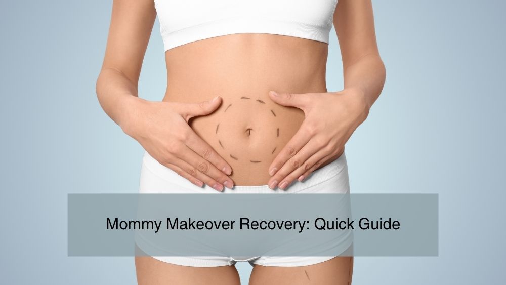 /Mommy Makeover Recovery Guide