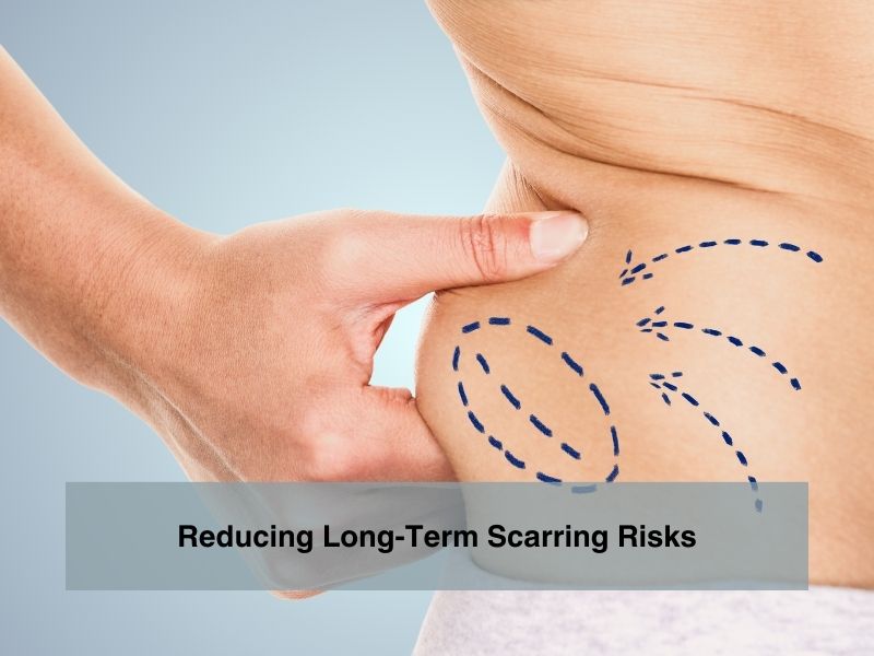 Reducing Long Term Scarring Risks
