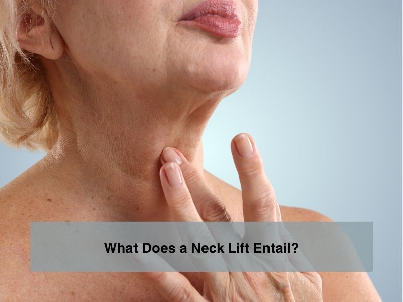 What Does a Neck Lift Entail