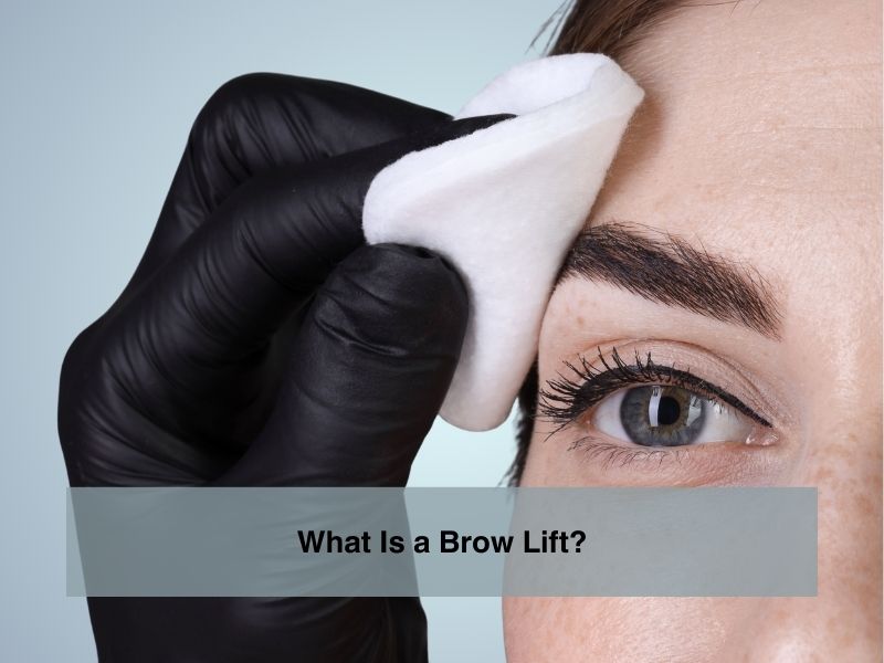 What Is a Brow Lift