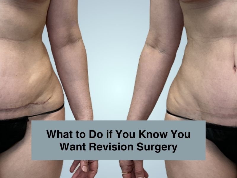 What to Do if You Know You Want Revision Surgery