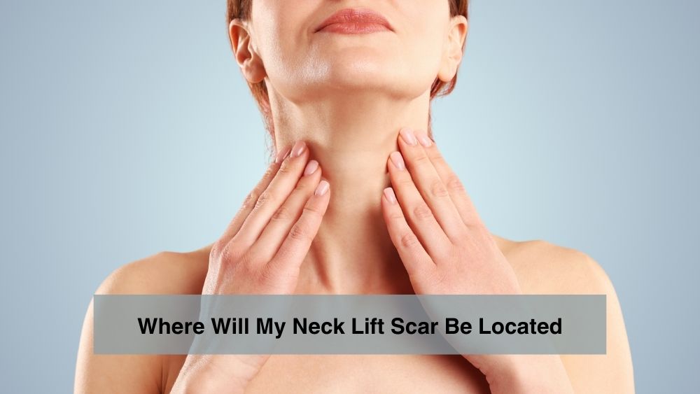 Where Neck Lift Scar Be Located