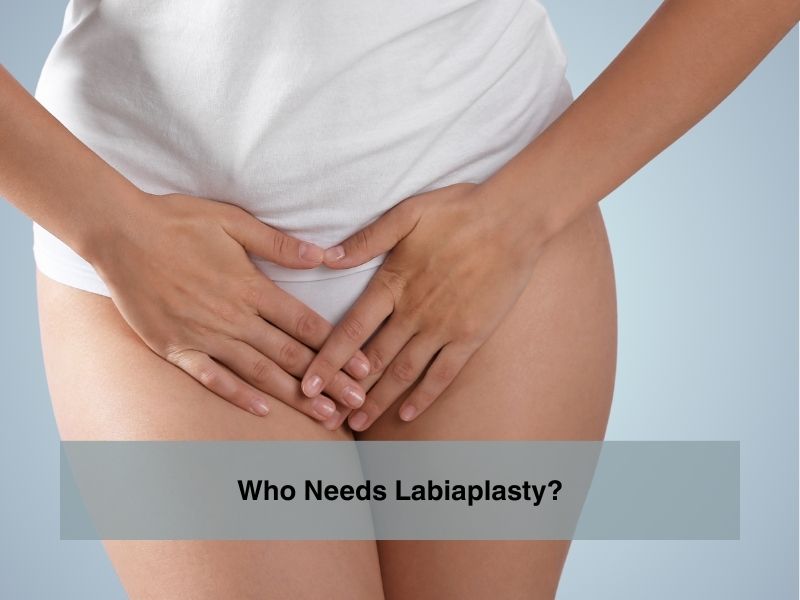 Who Needs Labiaplasty