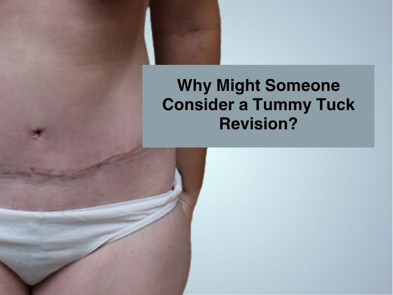Why Might Someone Consider a Tummy Tuck Revision