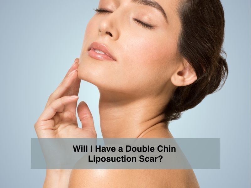 Will I Have a Double Chin Liposuction Scar