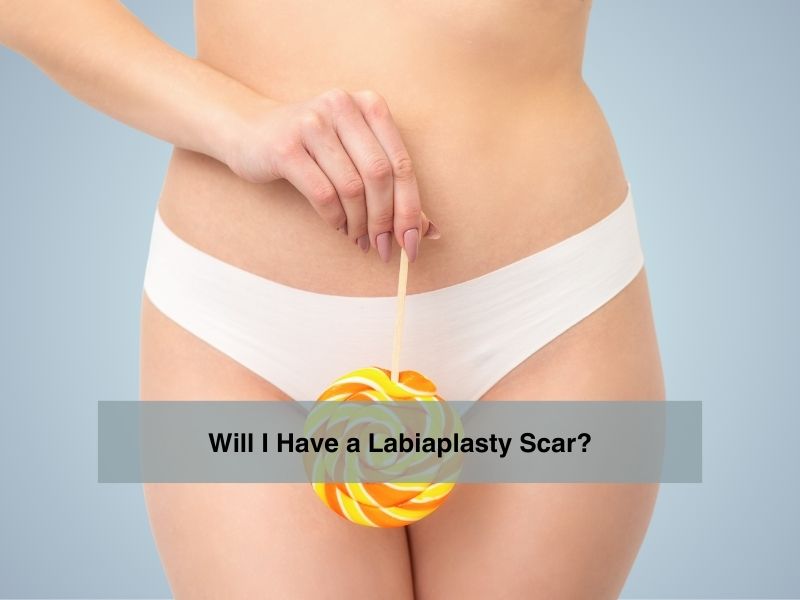 /Will I Have a Labiaplasty Scar