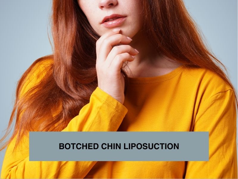botched chin liposuction