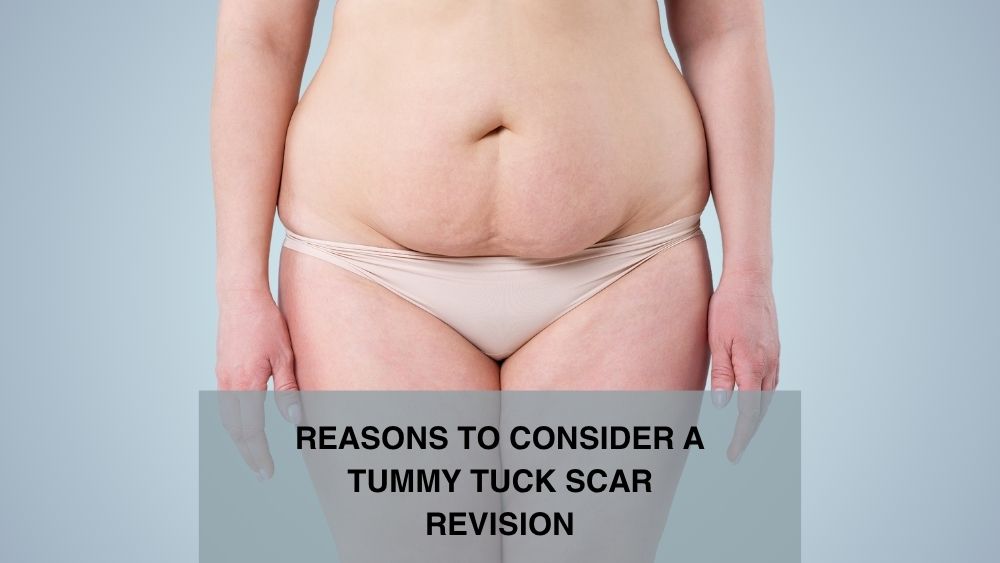 reasons consider tummy tuck scar revision